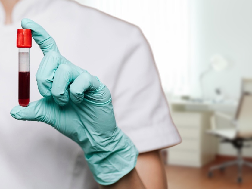 Hematologická ambulance - Nemocnice Slaný