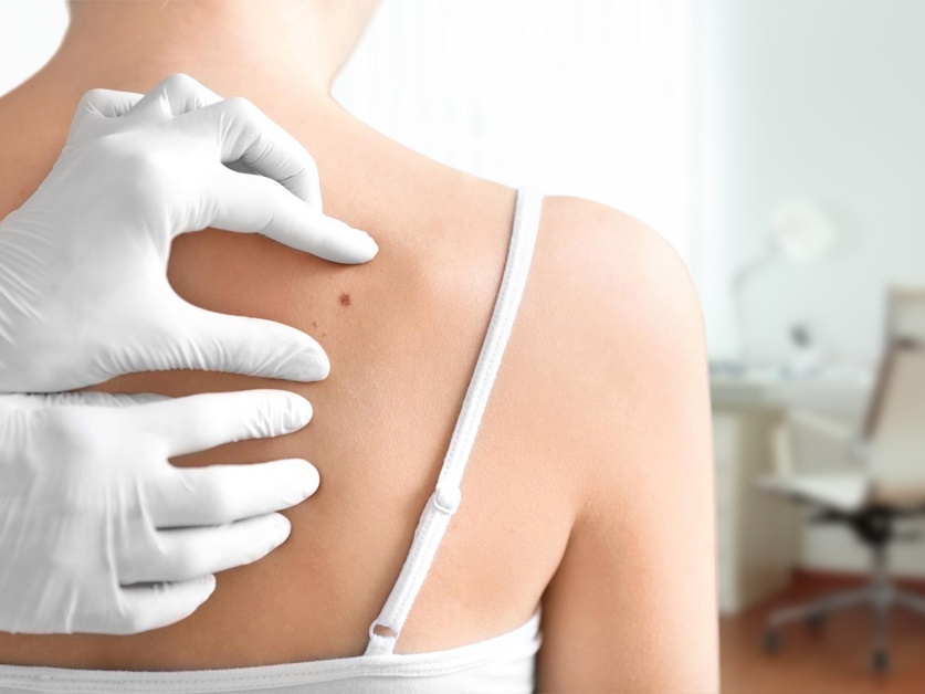 Kožní ordinace - MUDr. Lucie Bezděková